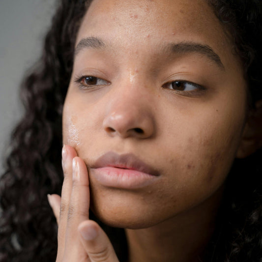 Blackheads, Whiteheads and Pimples. What's the difference?